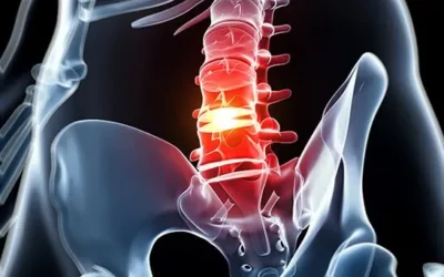 Could You Have A Herniated Disc?