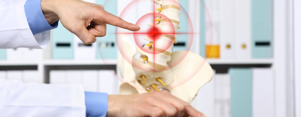 Back Pain is Commonly Caused by Herniated Discs - Do You Know Where Your Pain is Coming From?