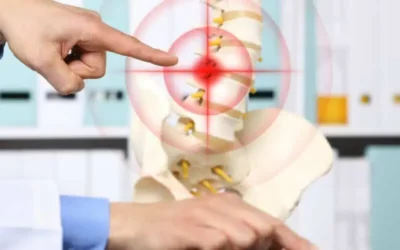 Back Pain is Commonly Caused by Herniated Discs – Do You Know Where Your Pain is Coming From?